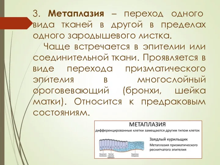 3. Метаплазия – переход одного вида тканей в другой в пределах одного зародышевого