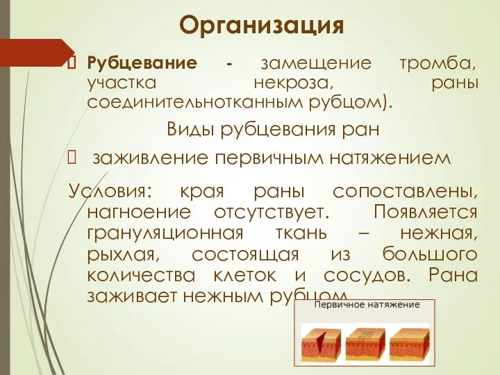 Организация Рубцевание - замещение тромба, участка некроза, раны соединительнотканным рубцом).