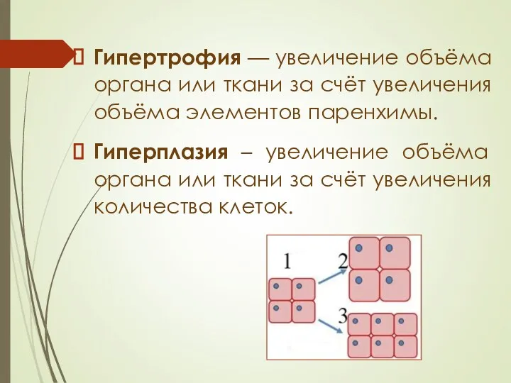 Гипертрофия — увеличение объёма органа или ткани за счёт увеличения объёма элементов паренхимы.