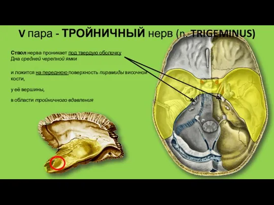 V пара - ТРОЙНИЧНЫЙ нерв (n. TRIGEMINUS) Ствол нерва проникает