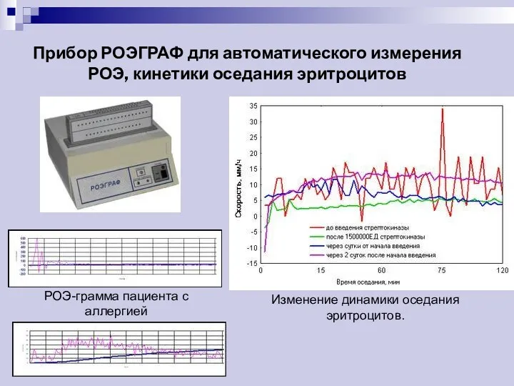 Прибор РОЭГРАФ для автоматического измерения РОЭ, кинетики оседания эритроцитов РОЭ-грамма