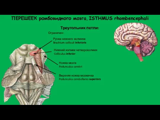 ПЕРЕШЕЕК ромбовидного мозга, ISTHMUS rhombencephali Треугольник петли: Нижний холмик четверохолмия