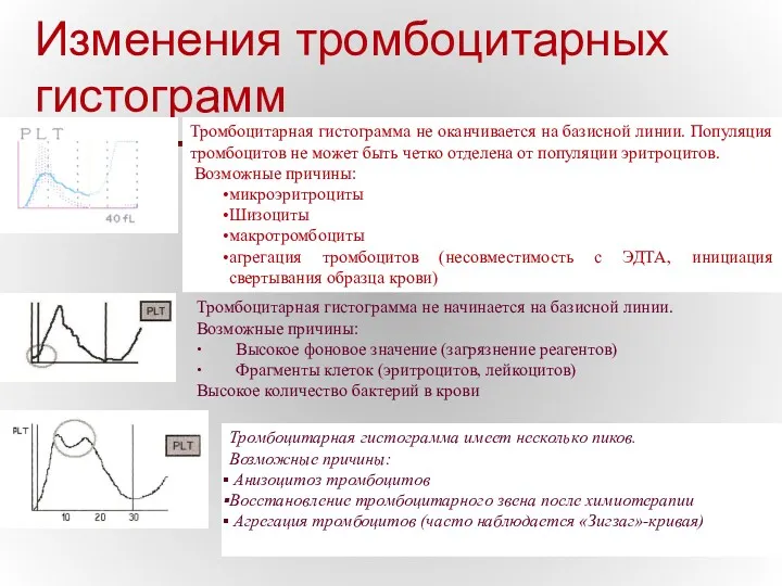 Изменения тромбоцитарных гистограмм Тромбоцитарная гистограмма не оканчивается на базисной линии.