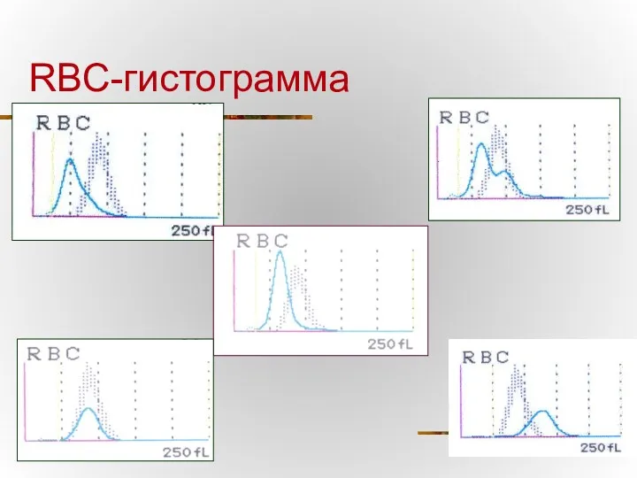 RBC-гистограмма