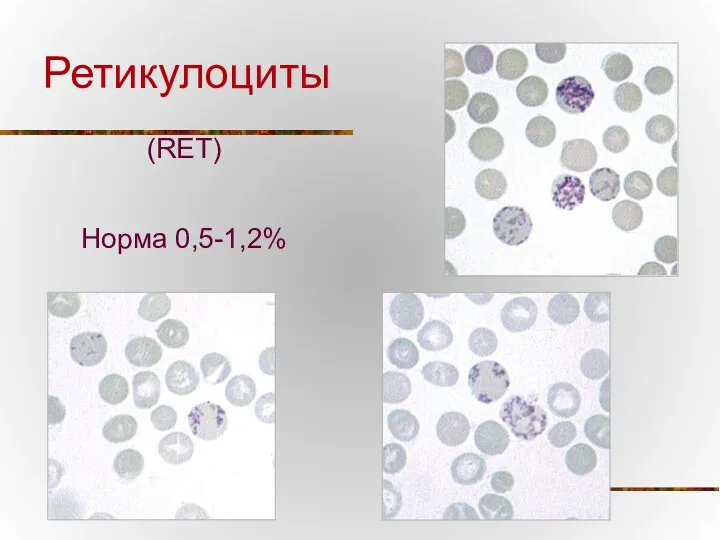 Ретикулоциты (RET) Норма 0,5-1,2%