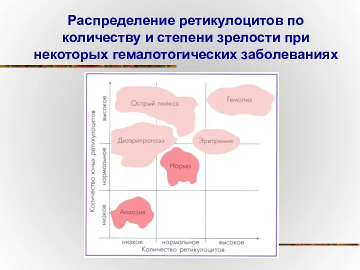 Распределение ретикулоцитов по количеству и степени зрелости при некоторых гемалотогических заболеваниях