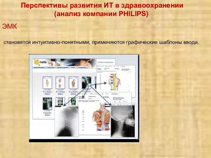 Перспективы развития ИТ в здравоохранении (анализ компании PHILIPS) ЭМК становятся интуитивно-понятными, применяются графические шаблоны ввода.