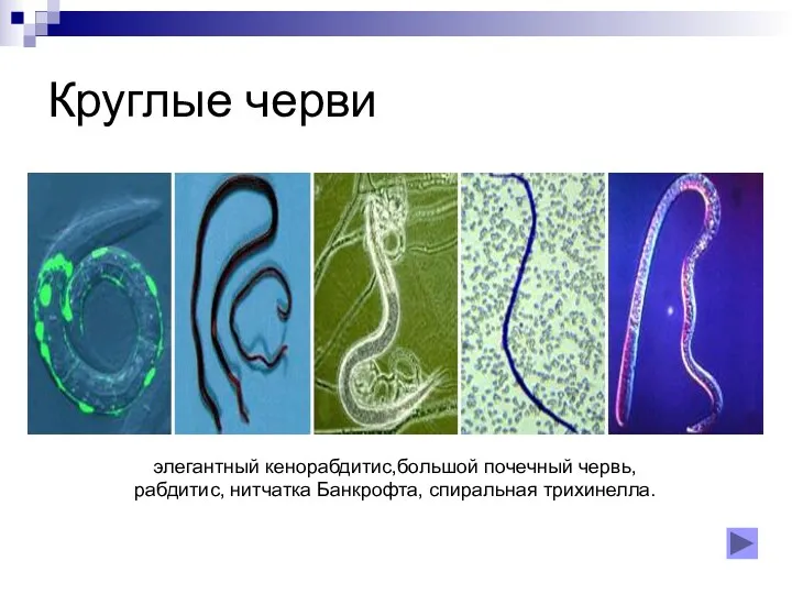 элегантный кенорабдитис,большой почечный червь, рабдитис, нитчатка Банкрофта, спиральная трихинелла. Круглые черви