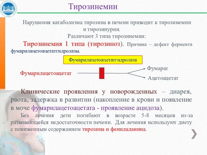 Нарушения катаболизма тирозина в печени приводит к тирозинемии и тирозинурии.