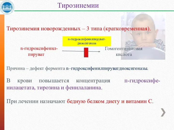 Тирозинемия новорожденных – 3 типа (кратковременная). Причина – дефект фермента