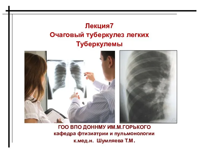 Очаговый туберкулез легких. Туберкулемы. Лекция 7