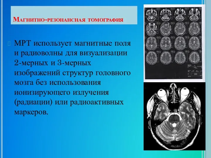 Магнитно-резонансная томография МРТ использует магнитные поля и радиоволны для визуализации