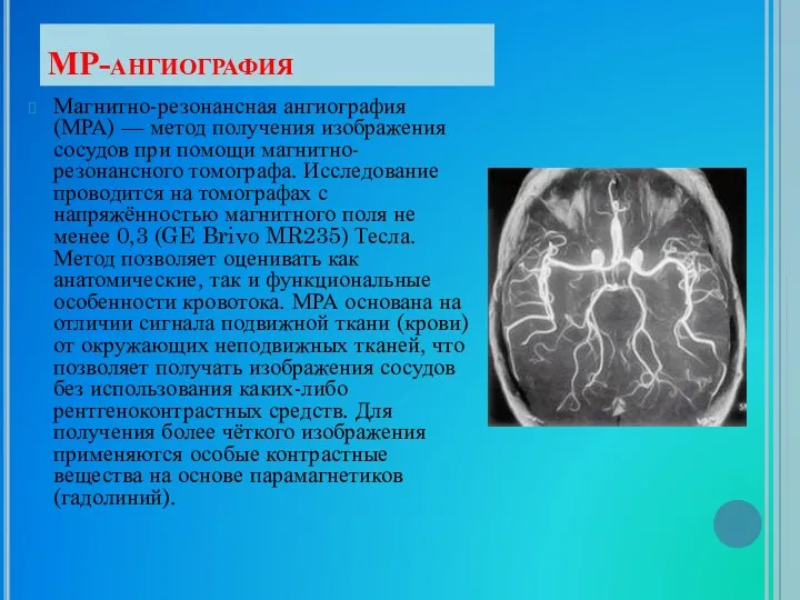 МР-ангиография Магнитно-резонансная ангиография (МРА) — метод получения изображения сосудов при