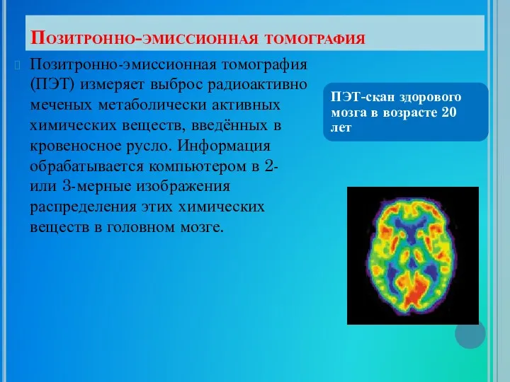 Позитронно-эмиссионная томография Позитронно-эмиссионная томография (ПЭТ) измеряет выброс радиоактивно меченых метаболически