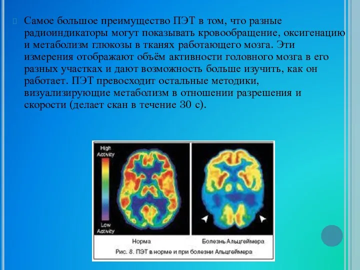 Самое большое преимущество ПЭТ в том, что разные радиоиндикаторы могут