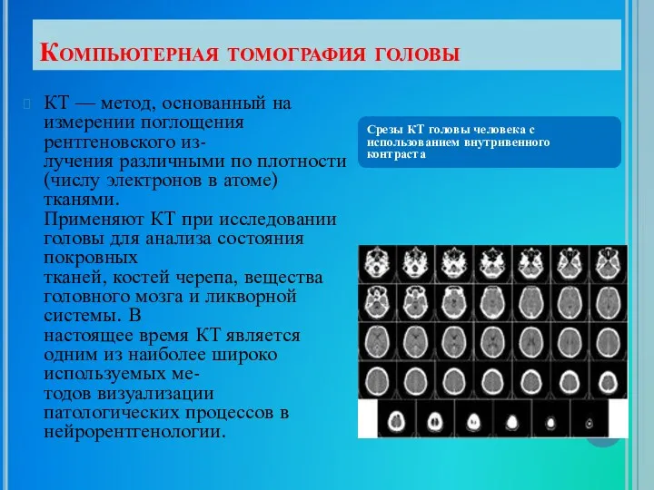 Компьютерная томография головы КТ — метод, основанный на измерении поглощения