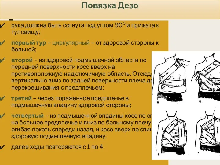 Повязка Дезо рука должна быть согнута под углом 900 и