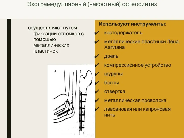 Экстрамедуллярный (накостный) остеосинтез осуществляют путём фиксации отломков с помощью металлических