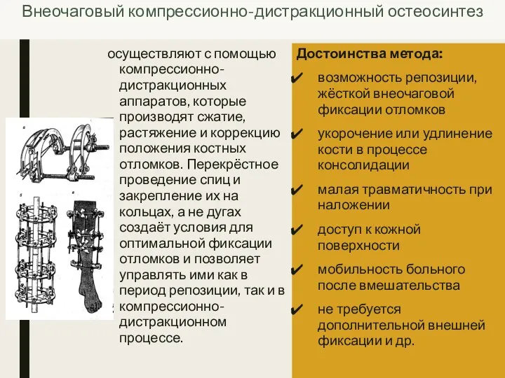 Внеочаговый компрессионно-дистракционный остеосинтез осуществляют с помощью компрессионно-дистракционных аппаратов, которые производят