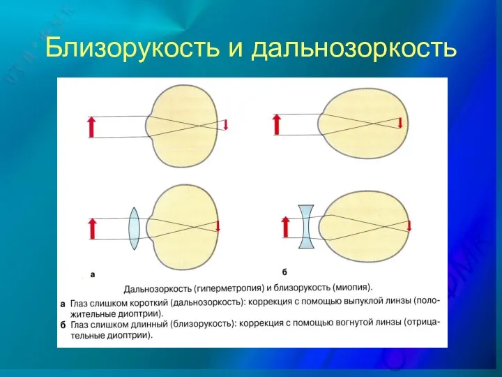 Близорукость и дальнозоркость