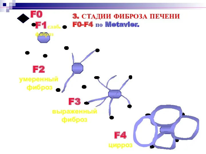 F0 F1слаб. фиброз F2 умеренный фиброз F3 выраженный фиброз F4 цирроз 3. СТАДИИ