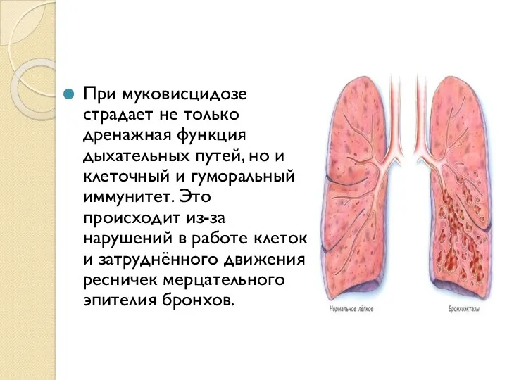 При муковисцидозе страдает не только дренажная функция дыхательных путей, но