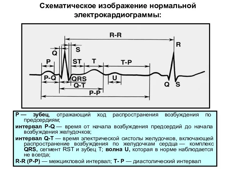 Схематическое изображение нормальной электрокардиограммы: Р — зубец, отражающий ход распространения возбуждения по предсердиям;