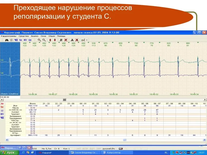 Преходящее нарушение процессов реполяризации у студента С.