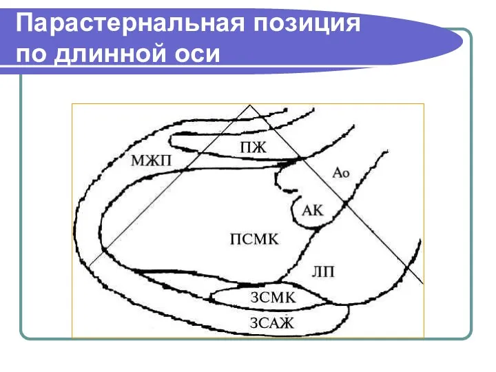 Парастернальная позиция по длинной оси