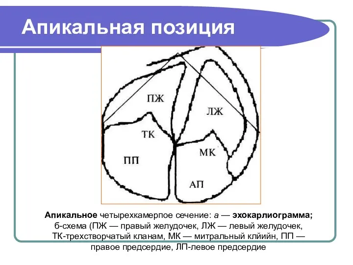 Апикальная позиция Апикальное четырехкамерпое сечение: а — эхокарлиограмма; б-схема (ПЖ — правый желудочек,