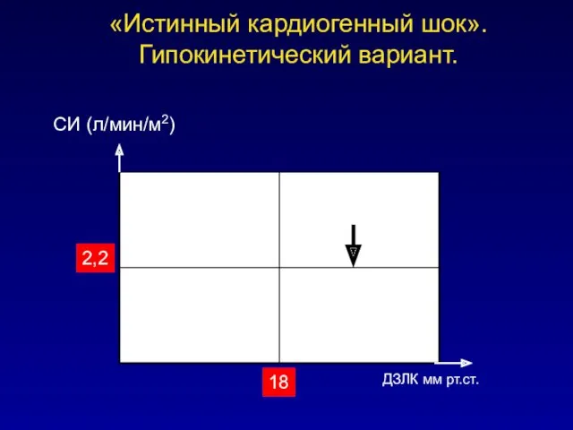 «Истинный кардиогенный шок». Гипокинетический вариант. СИ (л/мин/м2) 18 ДЗЛК мм рт.ст. 2,2