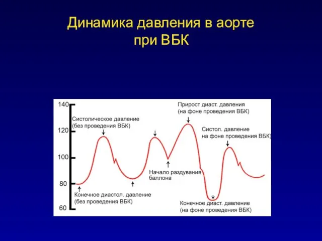 Динамика давления в аорте при ВБК