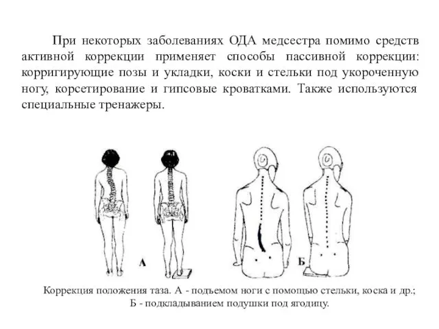 При некоторых заболеваниях ОДА медсестра помимо средств активной коррекции применяет