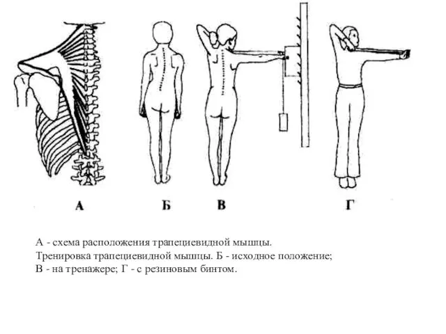 А - схема расположения трапециевидной мышцы. Тренировка трапециевидной мышцы. Б