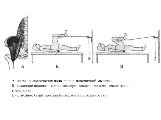 А - схема расположения подвздошно-поясничной мышцы; Б - исходное положение