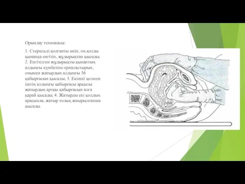 Орындау техникасы: 1. Стерильді қолғапты киіп, оң қолды қынапқа енгізіп,