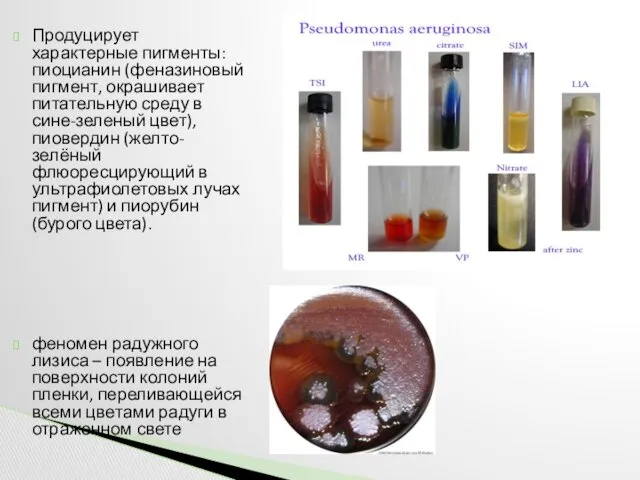 Продуцирует характерные пигменты: пиоцианин (феназиновый пигмент, окрашивает питательную среду в