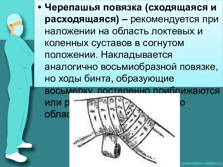 Черепашья повязка (сходящаяся и расходящаяся) – рекомендуется при наложении на