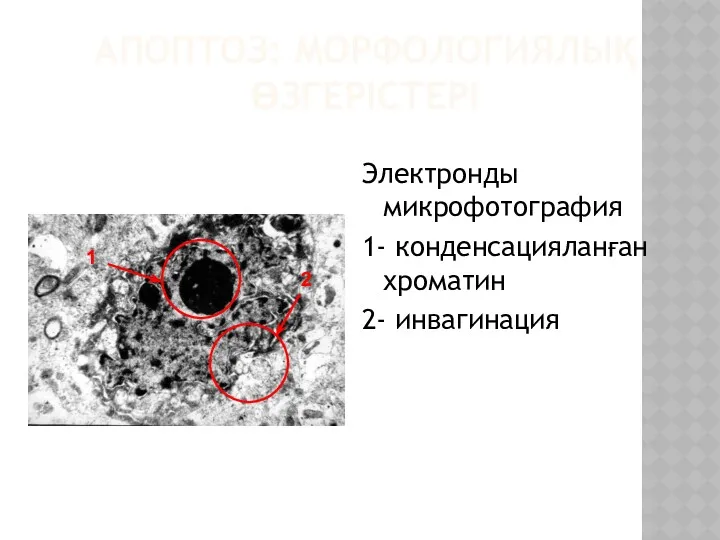 АПОПТОЗ: МОРФОЛОГИЯЛЫҚ ӨЗГЕРІСТЕРІ Электронды микрофотография 1- конденсацияланған хроматин 2- инвагинация 2 1