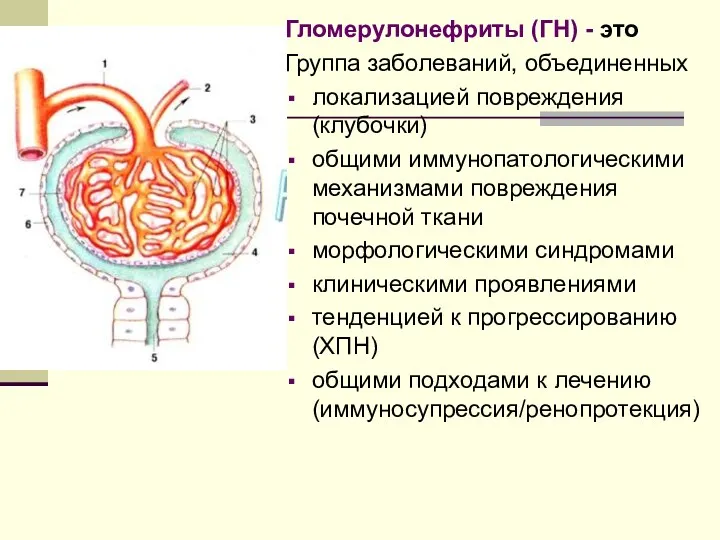 Гломерулонефриты (ГН) - это Группа заболеваний, объединенных локализацией повреждения (клубочки)