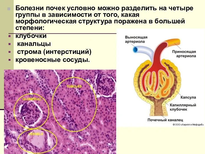 Болезни почек условно можно разделить на четыре группы в зависимости