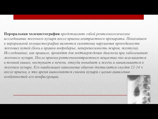 Пероральная холецистография представляет собой рентгенологическое исследование желчного пузыря после приема