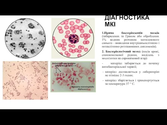 ДІАГНОСТИКА МКІ 1.Пряма бактеріоскопія мазків (забарвлених за Грамом або оброблених