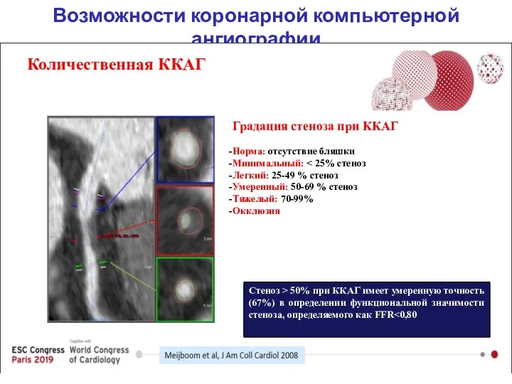 Возможности коронарной компьютерной ангиографии Количественная ККАГ Градация стеноза при ККАГ