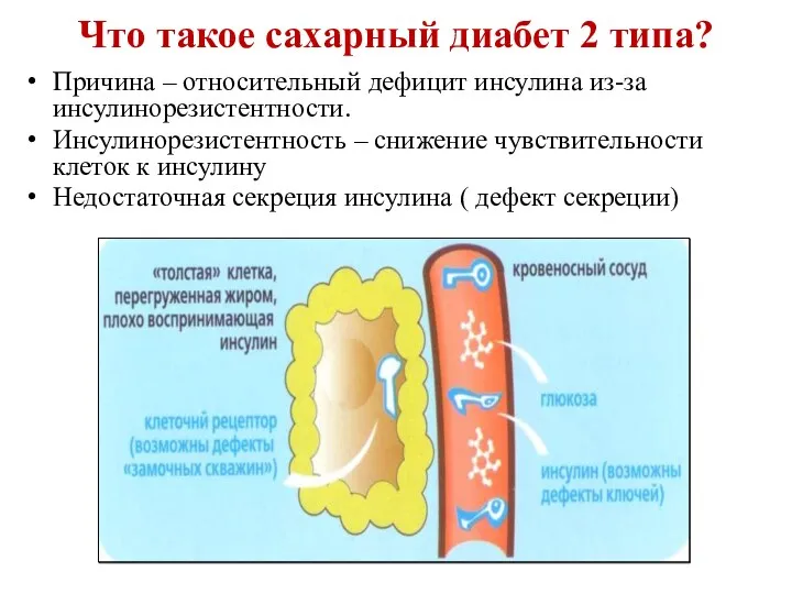 Что такое сахарный диабет 2 типа? Причина – относительный дефицит