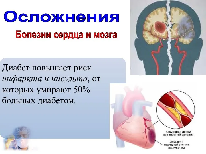 Осложнения Болезни сердца и мозга Диабет повышает риск инфаркта и