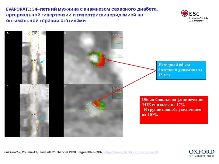 Eur Heart J, Volume 41, Issue 40, 21 October 2020,