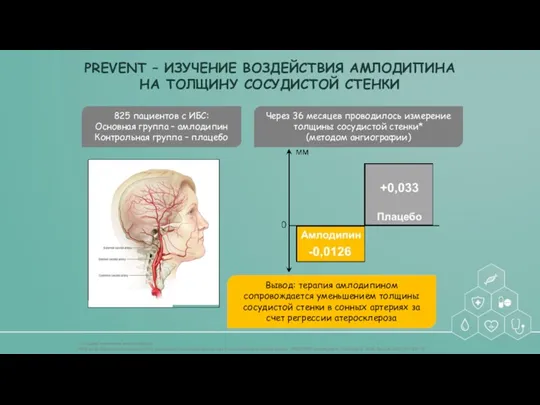 PREVENT – ИЗУЧЕНИЕ ВОЗДЕЙСТВИЯ АМЛОДИПИНА НА ТОЛЩИНУ СОСУДИСТОЙ СТЕНКИ *