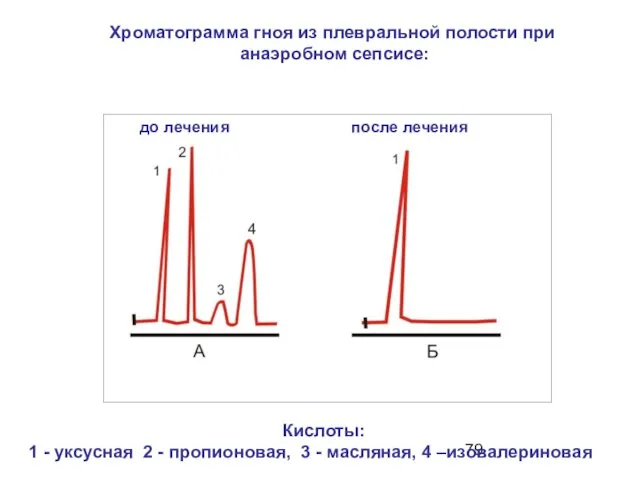 до лечения после лечения Хроматограмма гноя из плевральной полости при анаэробном сепсисе: Кислоты: