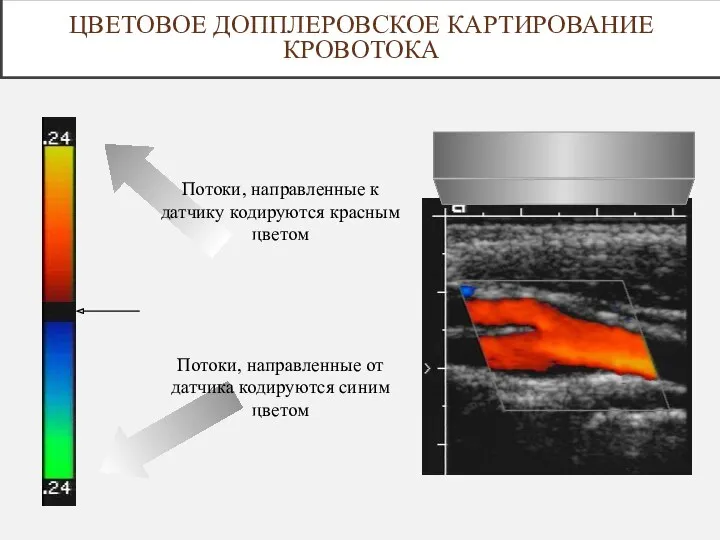 ЦВЕТОВОЕ ДОППЛЕРОВСКОЕ КАРТИРОВАНИЕ КРОВОТОКА